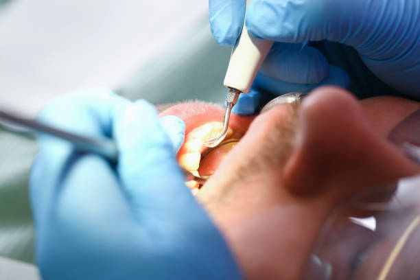 Best Knocked-Out Tooth Emergency  in Woods Hole, MA