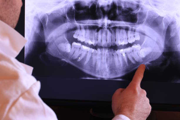 Best Teeth Whitening  in Woods Hole, MA